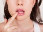 Топ-10 способов лечения герпеса на губах в домашних условиях