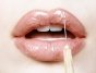 Как заполучить пышные уста: увеличение губ гиалуроновой кислотой